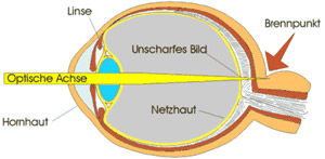 weitsichtig wissen optik hees